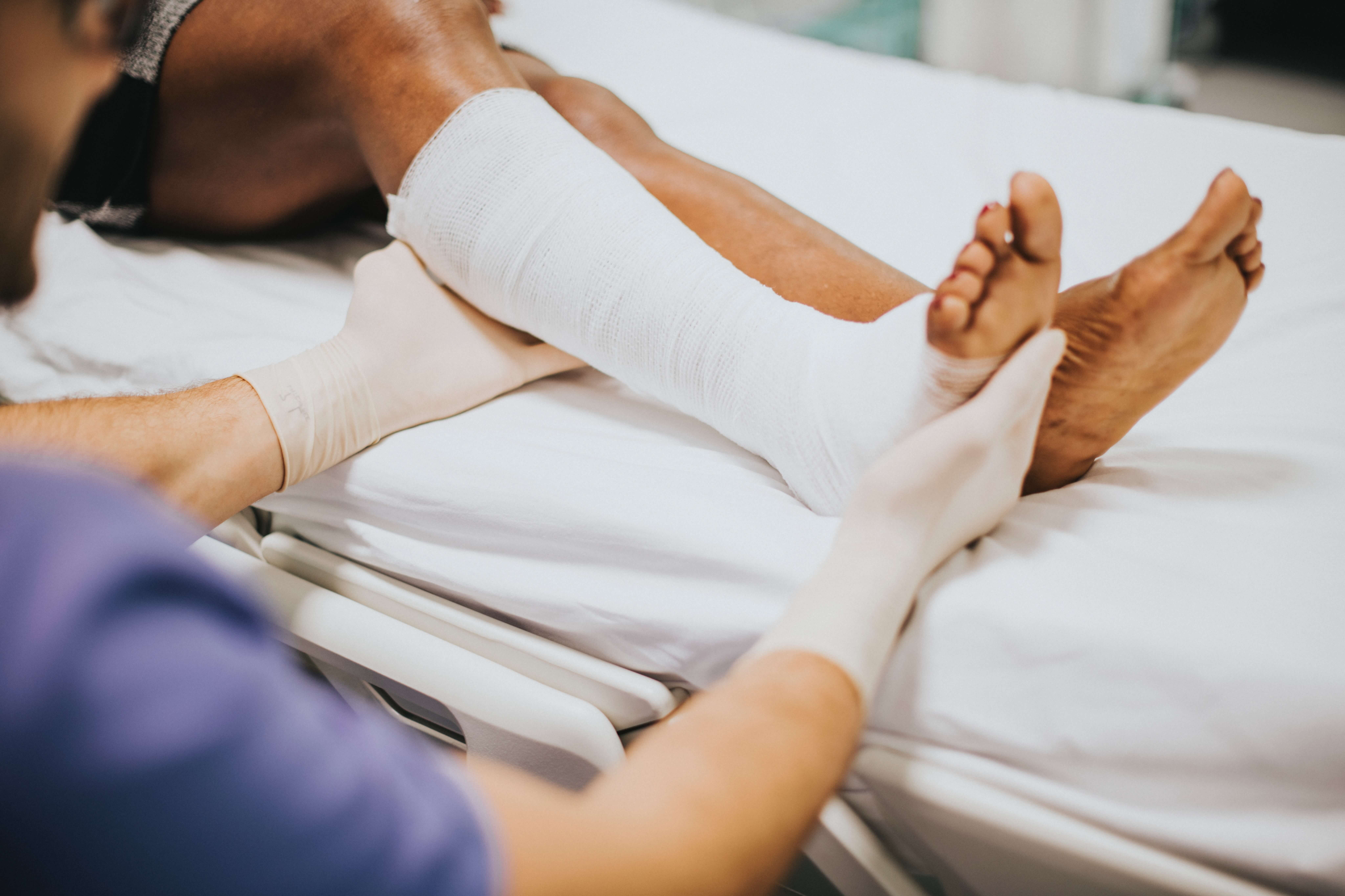 nurse holding a patients broken leg in a cast